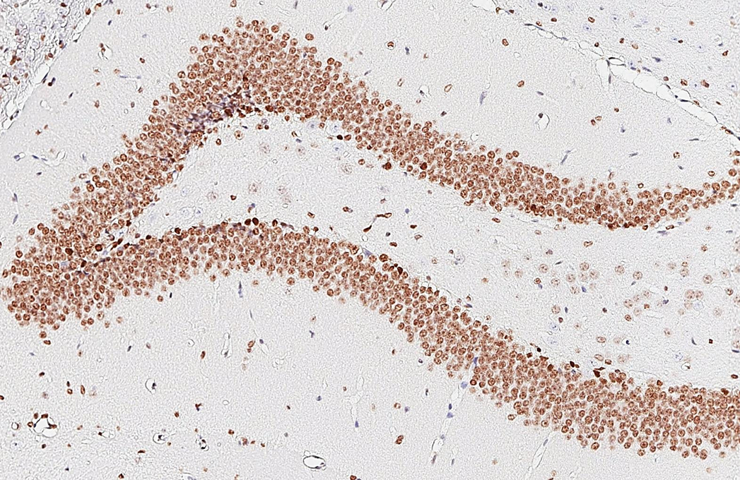 NFIX antibody [HL1269] detects NFIX protein by immunohistochemical analysis. Sample: Paraffin-embedded mouse hippocampus. NFIX stained by NFIX antibody [HL1269] (GTX636671) diluted at 1:800. Antigen Retrieval: Citrate buffer, pH 6.0, 15 min