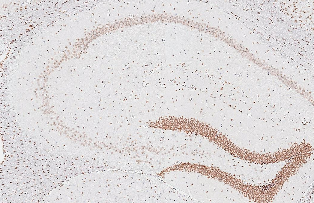 NFIX antibody [HL1269] detects NFIX protein by immunohistochemical analysis. Sample: Paraffin-embedded mouse hippocampus. NFIX stained by NFIX antibody [HL1269] (GTX636671) diluted at 1:800. Antigen Retrieval: Citrate buffer, pH 6.0, 15 min