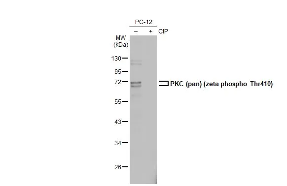 Anti-PKC (pan) (zeta phospho Thr410) antibody [HL1279