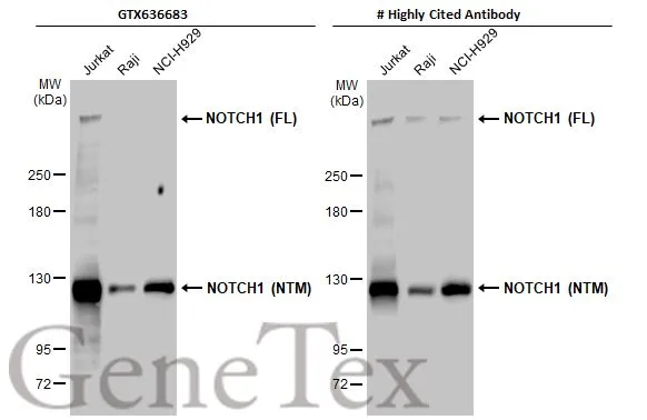 Various whole cell extracts (30 μg) were separated by 5% SDS-PAGE, and the membranes were blotted with NOTCH1 antibody [HL1281] (GTX636683) diluted at 1:1000 and competitor's antibody (# Highly Cited Antibody) diluted at 1:1000. The HRP-conjugated anti-rabbit IgG antibody (GTX213110-01) was used to detect the primary antibody, and the signal was developed with Trident ECL plus-Enhanced. *The competitor is not affiliated with GeneTex and does not endorse this product.