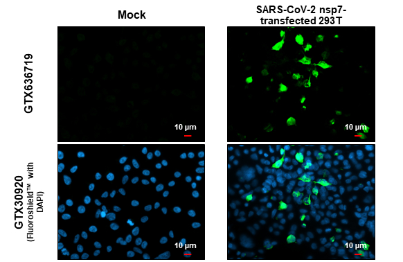 SARS-CoV-2 (COVID-19) nsp7 antibody [HL1301] detects SARS-CoV-2 (COVID-19) nsp7 protein at cytoplasm and nucleus by immunofluorescent analysis. Sample: Mock and transfected 293T cells were fixed in 4% paraformaldehyde at RT for 15 min. Green: SARS-CoV-2 (COVID-19) nsp7 stained by SARS-CoV-2 (COVID-19) nsp7 antibody [HL1301] (GTX636719) diluted at 1:500. Blue: Fluoroshield with DAPI (GTX30920). Scale bar= 10μm.