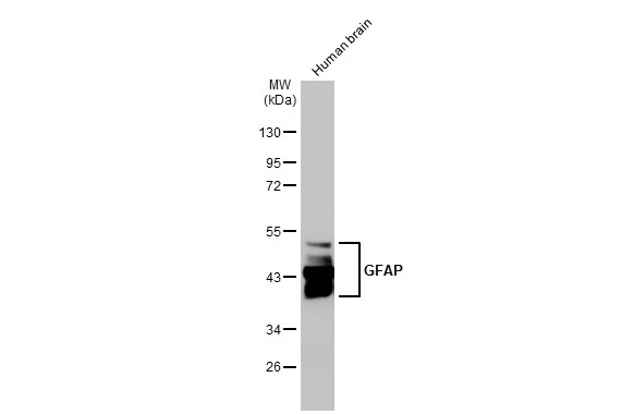 Human tissue extract (30 μg) was separated by 10% SDS-PAGE, and the membrane was blotted with GFAP antibody [HL1307] (GTX636725) diluted at 1:100000. The HRP-conjugated anti-rabbit IgG antibody (GTX213110-01) was used to detect the primary antibody.