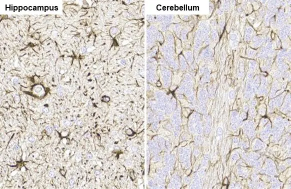 GFAP antibody [HL1307] detects GFAP protein by immunohistochemical analysis. Sample: Paraffin-embedded rat tissue. GFAP stained by GFAP antibody [HL1307] (GTX636725) diluted at 1:100. Antigen Retrieval: Citrate buffer, pH 6.0, 15 min