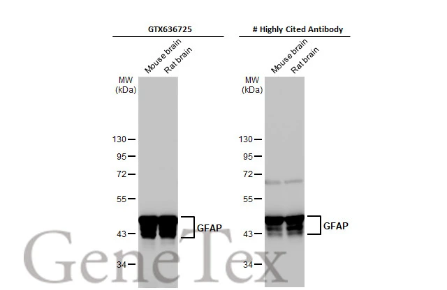 Various tissue extracts (50 μg) were separated by 10% SDS-PAGE, and the membranes were blotted with GFAP antibody [HL1307] (GTX636725) diluted at 1:3000 and competitor's antibody (CST 34001) diluted at 1:3000. The HRP-conjugated anti-rabbit IgG antibody (GTX213110-01) was used to detect the primary antibody. *The competitor is not affiliated with GeneTex and does not endorse this product.
