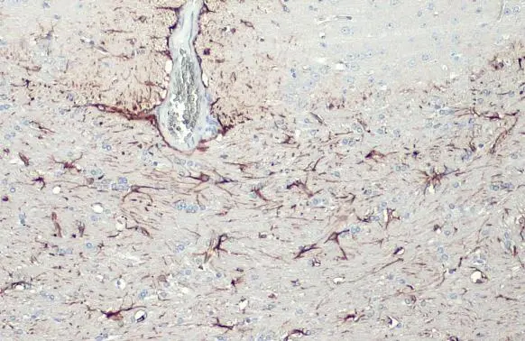 GFAP antibody [HL1307] detects GFAP protein at cytoplasm by immunohistochemical analysis. Sample: Paraffin-embedded mouse brain. GFAP stained by GFAP antibody [HL1307] (GTX636725) diluted at 1:100. Antigen Retrieval: Citrate buffer, pH 6.0, 15 min