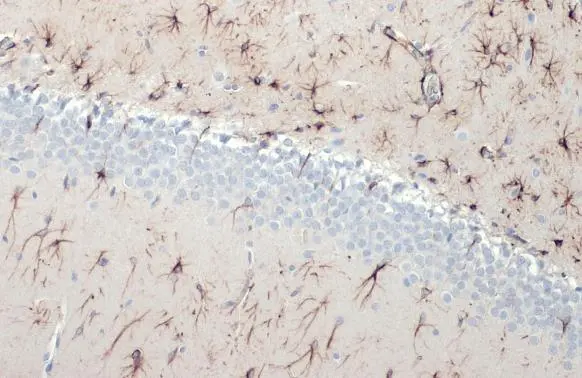 GFAP antibody [HL1307] detects GFAP protein at cytoplasm by immunohistochemical analysis. Sample: Paraffin-embedded rat brain. GFAP stained by GFAP antibody [HL1307] (GTX636725) diluted at 1:100. Antigen Retrieval: Citrate buffer, pH 6.0, 15 min
