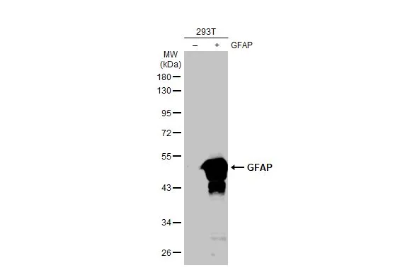 Non-transfected (–) and transfected (+) 293T whole cell extracts (30 μg) were separated by 10% SDS-PAGE, and the membrane was blotted with GFAP antibody [HL1307] (GTX636725) diluted at 1:5000. The HRP-conjugated anti-rabbit IgG antibody (GTX213110-01) was used to detect the primary antibody.