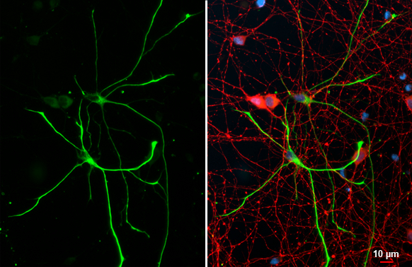 GFAP antibody [HL1308] detects GFAP protein at glia cells by immunofluorescent analysis. Sample: DIV10 rat E18 primary hippocampal neuron and glia cells were fixed in 4% paraformaldehyde at RT for 15 min. Green: GFAP stained by GFAP antibody [HL1308] (GTX636726) diluted at 1:250. Red: Tau, a cytoskeleton marker, stained by Tau antibody [GT287] (GTX634809) diluted at 1:500. Blue: Fluoroshield with DAPI (GTX30920).
