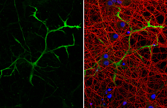 GFAP antibody [HL1308] detects GFAP protein at glia cells by immunofluorescent analysis. Sample: DIV9 rat E18 primary cortical neuron and glia cells were fixed in 4% paraformaldehyde at RT for 15 min. Green: GFAP stained by GFAP antibody [HL1308] (GTX636726) diluted at 1:250. Red: Tau, an axon marker, stained by Tau antibody [GT287] (GTX634809) diluted at 1:500. Blue: Fluoroshield with DAPI (GTX30920).