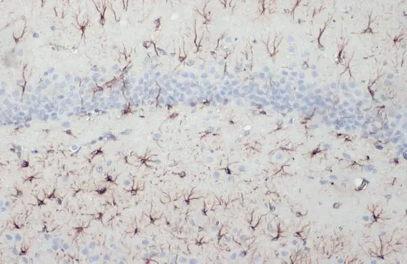 GFAP antibody [HL1308] detects GFAP protein at cytoplasm by immunohistochemical analysis. Sample: Paraffin-embedded rat brain. GFAP stained by GFAP antibody [HL1308] (GTX636726) diluted at 1:100. Antigen Retrieval: Citrate buffer, pH 6.0, 15 min