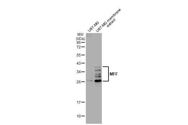 U87-MG whole cell and membrane extracts (30 μg) were separated by 12% SDS-PAGE, and the membrane was blotted with MFF antibody [HL1311] (GTX636729) diluted at 1:1000. The HRP-conjugated anti-rabbit IgG antibody (GTX213110-01) was used to detect the primary antibody.