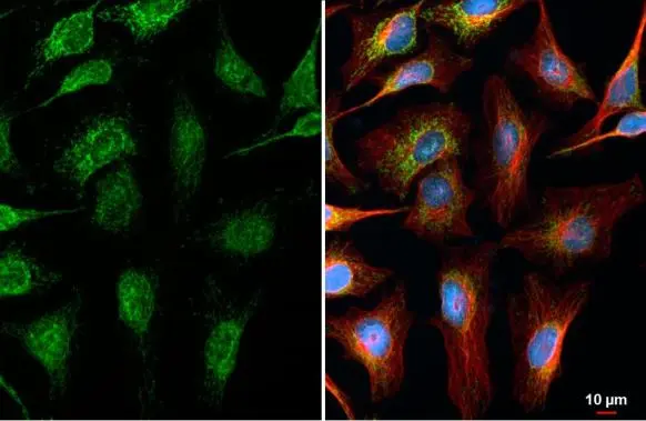 MFF antibody [HL1311] detects MFF protein at mitochondria by immunofluorescent analysis. Sample: HeLa cells were fixed in ice-cold MeOH for 5 min. Green: MFF stained by MFF antibody [HL1311] (GTX636729) diluted at 1:4500. Red: alpha Tubulin, a cytoskeleton marker, stained by alpha Tubulin antibody [GT114] (GTX628802) diluted at 1:1000. Blue: Fluoroshield with DAPI (GTX30920).