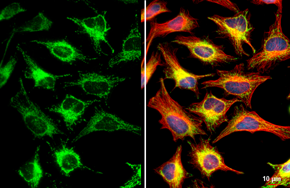 MFF antibody [HL1312] detects MFF protein at mitochondria by immunofluorescent analysis. Sample: HeLa cells were fixed in ice-cold MeOH for 5 min. Green: MFF stained by MFF antibody [HL1312] (GTX636730) diluted at 1:500. Red: alpha Tubulin, a cytoskeleton marker, stained by alpha Tubulin antibody [GT114] (GTX628802) diluted at 1:1000. Blue: Fluoroshield with DAPI (GTX30920). Scale bar= 10μm.