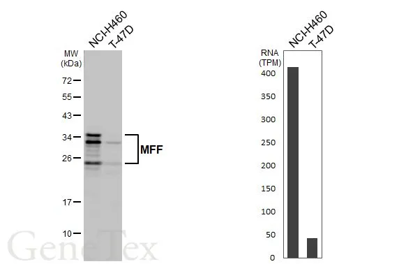 Various whole cell extracts (30 μg) were separated by 12% SDS-PAGE, and the membrane was blotted with MFF antibody [HL1312] (GTX636730) diluted at 1:1000. The HRP-conjugated anti-rabbit IgG antibody (GTX213110-01) was used to detect the primary antibody. Corresponding RNA expression data for the same cell lines are based on Human Protein Atlas program.