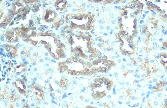 ATP6V1H antibody [HL1316]