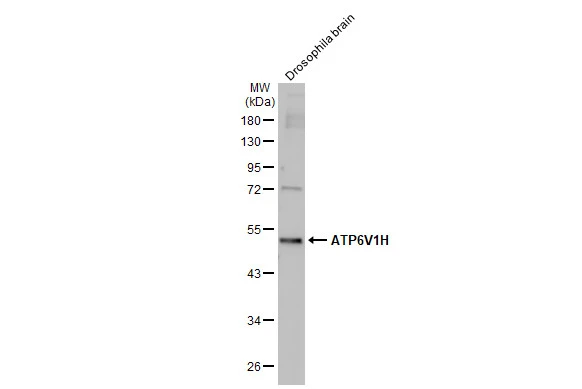 ATP6V1H antibody [HL1316]