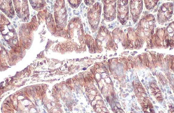 EpCAM antibody [HL1339]