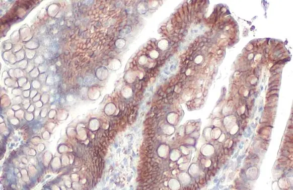 EpCAM antibody [HL1339]
