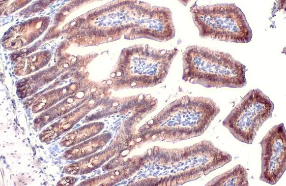 EpCAM antibody [HL1339]