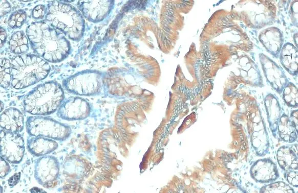GSPT1 antibody [HL1346] detects GSPT1 protein at cytoplasm by immunohistochemical analysis. Sample: Paraffin-embedded rat colon. GSPT1 stained by GSPT1 antibody [HL1346] (GTX636766) diluted at 1:100. Antigen Retrieval: Citrate buffer, pH 6.0, 15 min