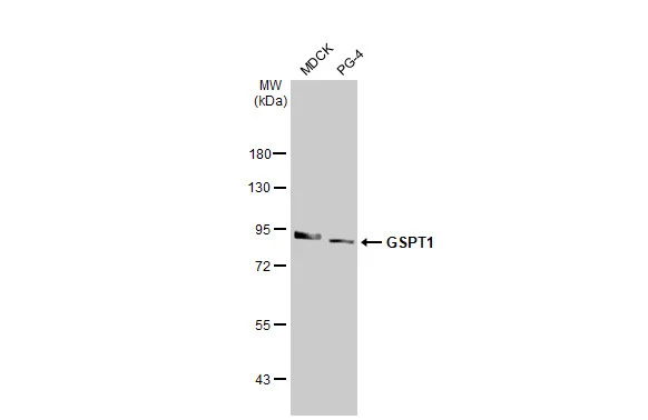 Various whole cell extracts (30 μg) were separated by 7.5% SDS-PAGE, and the membrane was blotted with GSPT1 antibody [HL1346] (GTX636766) diluted at 1:3000. The HRP-conjugated anti-rabbit IgG antibody (GTX213110-01) was used to detect the primary antibody.
