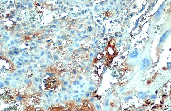 COL4A1 antibody [HL1351] detects COL4A1 protein at cell membrane and secreted by immunohistochemical analysis. Sample: Paraffin-embedded mouse placenta. COL4A1 stained by COL4A1 antibody [HL1351] (GTX636771) diluted at 1:100. Antigen Retrieval: Citrate buffer, pH 6.0, 15 min