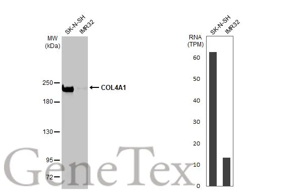 COL4A1 antibody [HL1351]