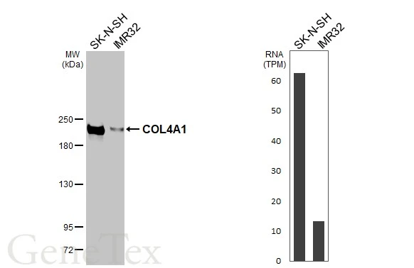 Various whole cell extracts (30 μg) were separated by 5% SDS-PAGE, and the membrane was blotted with COL4A1 antibody [HL1351] (GTX636771) diluted at 1:1000. The HRP-conjugated anti-rabbit IgG antibody (GTX213110-01) was used to detect the primary antibody. Corresponding RNA expression data for the same cell lines are based on Human Protein Atlas program.