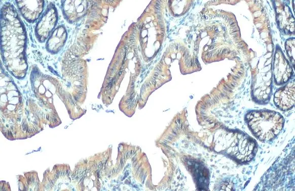 PDE6D antibody [HL1359] detects PDE6D protein at cytoplasm by immunohistochemical analysis. Sample: Paraffin-embedded rat colon. PDE6D stained by PDE6D antibody [HL1359] (GTX636799) diluted at 1:100. Antigen Retrieval: Citrate buffer, pH 6.0, 15 min