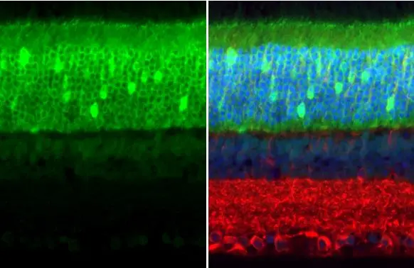 PDE6D antibody [HL1359] detects PDE6D protein at cytoplasm by immunohistochemical analysis. Sample: Paraffin-embedded mouse eye. Green: PDE6D stained by PDE6D antibody [HL1359] (GTX636799) diluted at 1:100. Red: beta Tubulin 3/ Tuj1, a neural marker, stained by beta Tubulin 3/ Tuj1 antibody [GT11710] (GTX631836) diluted at 1:500. Blue: Fluoroshield with DAPI (GTX30920). Antigen Retrieval: Citrate buffer, pH 6.0, 15 min