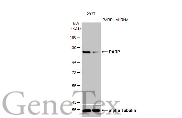 Non-transfected (–) and transfected (+) 293T whole cell extracts (30 μg) were separated by 7.5% SDS-PAGE, and the membrane was blotted with PARP antibody [HL1365] (GTX636805) diluted at 1:10000. The HRP-conjugated anti-rabbit IgG antibody (GTX213110-01) was used to detect the primary antibody.