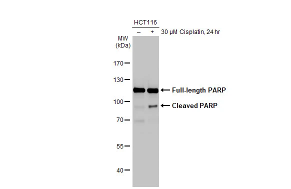 Untreated (–) and treated (+) HCT-116 whole cell extract (30 μg) were separated by 7.5% SDS-PAGE, and the membrane was blotted with PARP antibody [HL1365] (GTX636805) diluted at 1:10000. The HRP-conjugated anti-rabbit IgG antibody (GTX213110-01) was used to detect the primary antibody.