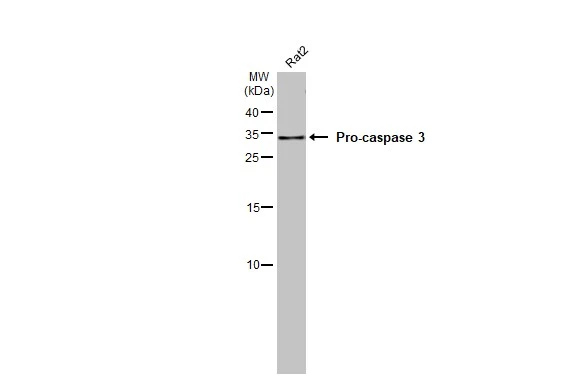 Whole cell extract (30 μg) was separated by 15% SDS-PAGE, and the membrane was blotted with Caspase 3 (cleaved Asp175) antibody [HL1370] (GTX636810) diluted at 1:1000. The HRP-conjugated anti-rabbit IgG antibody (GTX213110-01) was used to detect the primary antibody.
