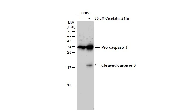 Untreated (–) and treated (+) Rat2 whole cell extracts (30 μg) were separated by 15% SDS-PAGE, and the membrane was blotted with Caspase 3 antibody [HL1370] (GTX636810) diluted at 1:500. The HRP-conjugated anti-rabbit IgG antibody (GTX213110-01) was used to detect the primary antibody, and the signal was developed with Trident ECL plus-Enhanced.