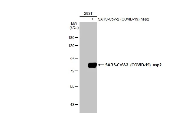 Non-transfected (–) and transfected (+) 293T whole cell extracts (30 μg) were separated by 7.5% SDS-PAGE, and the membrane was blotted with SARS-CoV-2 (COVID-19) nsp2 antibody [HL1371] (GTX636811) diluted at 1:5000. The HRP-conjugated anti-rabbit IgG antibody (GTX213110-01) was used to detect the primary antibody.