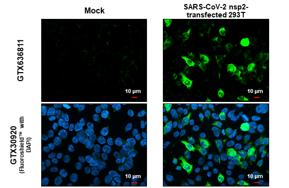 SARS-CoV-2 (COVID-19) nsp2 antibody [HL1371] detects SARS-CoV-2 (COVID-19) nsp2 protein at cytoplasm by immunofluorescent analysis. Sample: Mock and transfected 293T cells were fixed in 4% paraformaldehyde at RT for 15 min. Green: SARS-CoV-2 (COVID-19) nsp2 stained by SARS-CoV-2 (COVID-19) nsp2 antibody [HL1371] (GTX636811) diluted at 1:500. Blue: Fluoroshield with DAPI (GTX30920). Scale bar= 10μm.