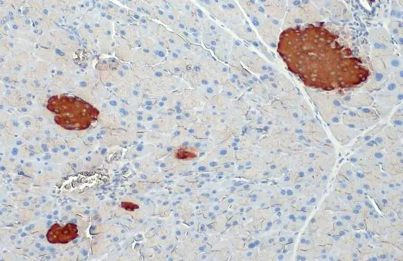 Insulin antibody [HL1393]