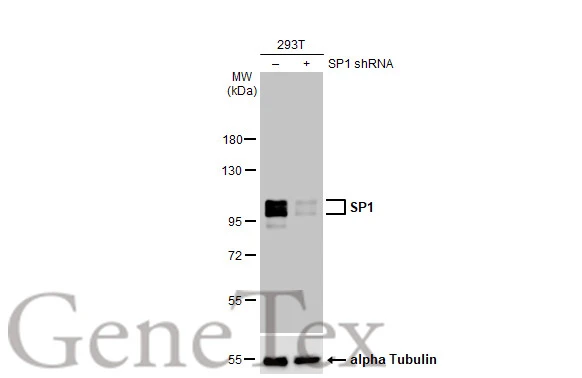 Non-transfected (–) and transfected (+) 293T whole cell extracts (30 μg) were separated by 7.5% SDS-PAGE, and the membrane was blotted with SP1 antibody [HL1396] (GTX636836) diluted at 1:10000. The HRP-conjugated anti-rabbit IgG antibody (GTX213110-01) was used to detect the primary antibody.