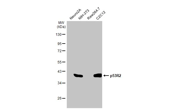 Various whole cell extracts (30 μg) were separated by 10% SDS-PAGE, and the membrane was blotted with p53R2 antibody [HL1400] (GTX636840) diluted at 1:1000. The HRP-conjugated anti-rabbit IgG antibody (GTX213110-01) was used to detect the primary antibody.