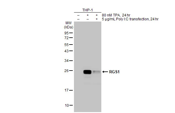 Untreated (–) and treated (+) THP-1 whole cell extracts (30 μg) were separated by 12% SDS-PAGE, and the membrane was blotted with RGS1 antibody [HL1402] (GTX636868) diluted at 1:1000. The HRP-conjugated anti-rabbit IgG antibody (GTX213110-01) was used to detect the primary antibody.