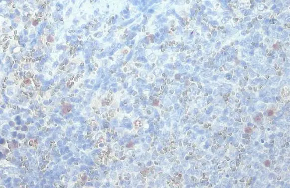 RGS1 antibody [HL1402] detects RGS1 protein at cytoplasm by immunohistochemical analysis. Sample: Paraffin-embedded mouse spleen. RGS1 stained by RGS1 antibody [HL1402] (GTX636868) diluted at 1:100. Antigen Retrieval: Citrate buffer, pH 6.0, 15 min