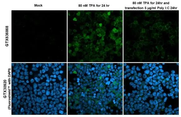 RGS1 antibody [HL1402] detects RGS1 protein at cell membrane by immunofluorescent analysis. Sample: Mock and treated THP-1 cells were fixed in 4% paraformaldehyde at RT for 15 min. Green: RGS1 stained by RGS1 antibody [HL1402] (GTX636868) diluted at 1:100. Blue: Fluoroshield with DAPI (GTX30920).