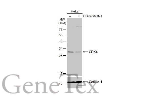 Non-transfected (–) and transfected (+) HeLa whole cell extracts (30 μg) were separated by 12% SDS-PAGE, and the membrane was blotted with CDK4 antibody [HL1407] (GTX636873) diluted at 1:1000. The HRP-conjugated anti-rabbit IgG antibody (GTX213110-01) was used to detect the primary antibody.