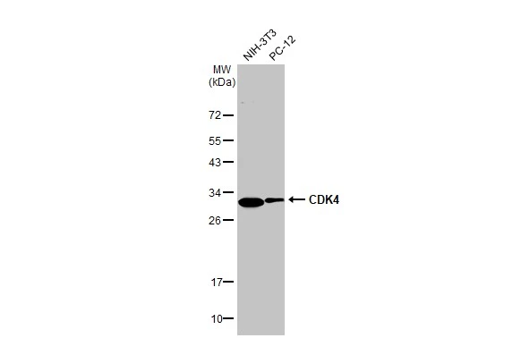 Various whole cell extracts (30 μg) were separated by 12% SDS-PAGE, and the membrane was blotted with CDK4 antibody [HL1407] (GTX636873) diluted at 1:1000. The HRP-conjugated anti-rabbit IgG antibody (GTX213110-01) was used to detect the primary antibody.