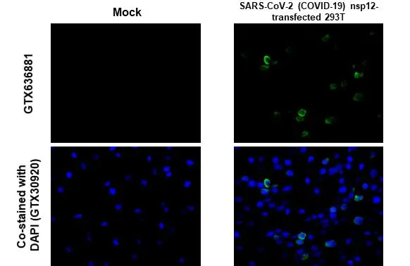 SARS-CoV-2 (COVID-19) nsp12 antibody [HL1415] detects SARS-CoV-2 (COVID-19) nsp12 protein by immunohistochemical analysis. Sample: SARS-CoV-2 (COVID-19) nsp12 transfected 293T cell FFPE Cell Pellet Block. Green: SARS-CoV-2 (COVID-19) nsp12 stained by SARS-CoV-2 (COVID-19) nsp12 antibody [HL1415] (GTX636881) diluted at 1:100. Blue: Fluoroshield with DAPI (GTX30920). Antigen Retrieval: Citrate buffer, pH 6.0, 15 min