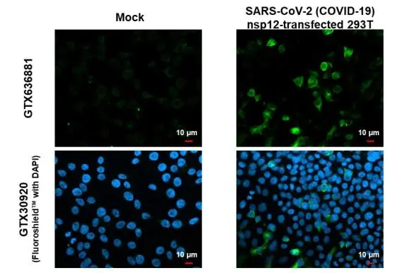 SARS-CoV-2 (COVID-19) nsp12 antibody [HL1415] detects SARS-CoV-2 (COVID-19) nsp12 protein by immunofluorescent analysis. Sample: Mock and transfected 293T cells were fixed in 4% paraformaldehyde at RT for 15 min. Green: SARS-CoV-2 (COVID-19) nsp12 stained by SARS-CoV-2 (COVID-19) nsp12 antibody [HL1415] (GTX636881) diluted at 1:500. Blue: Fluoroshield with DAPI (GTX30920).