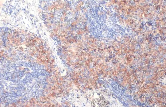 FCER1G antibody [HL1418] detects FCER1G protein at cell membrane by immunohistochemical analysis. Sample: Paraffin-embedded mouse spleen. FCER1G stained by FCER1G antibody [HL1418] (GTX636884) diluted at 1:100. Antigen Retrieval: Citrate buffer, pH 6.0, 15 min