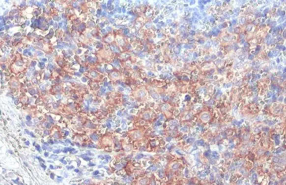 FCER1G antibody [HL1418] detects FCER1G protein at cell membrane by immunohistochemical analysis. Sample: Paraffin-embedded mouse spleen. FCER1G stained by FCER1G antibody [HL1418] (GTX636884) diluted at 1:100. Antigen Retrieval: Citrate buffer, pH 6.0, 15 min