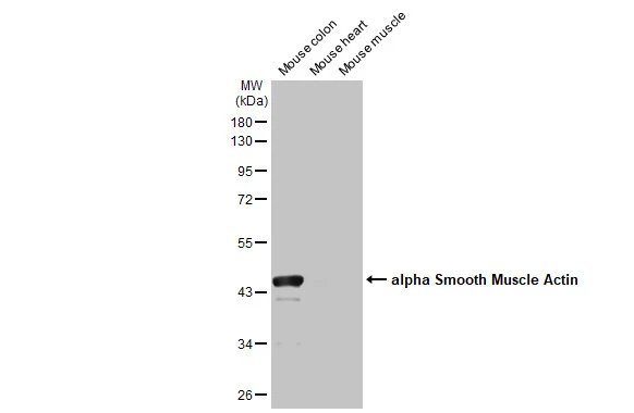 Various tissue extracts (50 μg) were separated by 10% SDS-PAGE, and the membrane was blotted with alpha Smooth Muscle Actin antibody [HL1419] (GTX636885) diluted at 1:10000. The HRP-conjugated anti-rabbit IgG antibody (GTX213110-01) was used to detect the primary antibody.