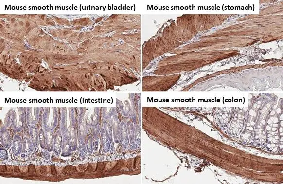 alpha Smooth Muscle Actin antibody [HL1419] detects alpha Smooth Muscle Actin protein by immunohistochemical analysis. Sample: Paraffin-embedded mouse tissues. alpha Smooth Muscle Actin stained by alpha Smooth Muscle Actin antibody [HL1419] (GTX636885) diluted at 1:100. Antigen Retrieval: Citrate buffer, pH 6.0, 15 min